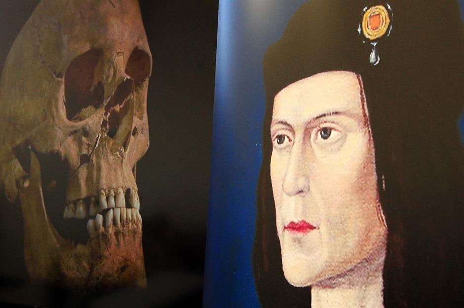 Body of Richard III